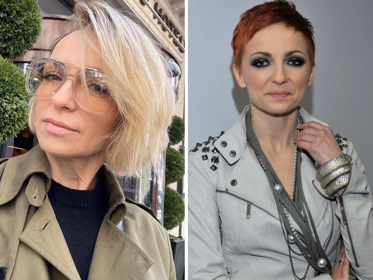 Czy Ania Wyszkoni miała operację plastyczną?