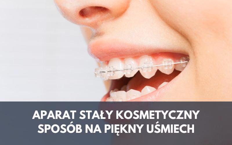 Czy po zdjęciu aparatu wada wraca?