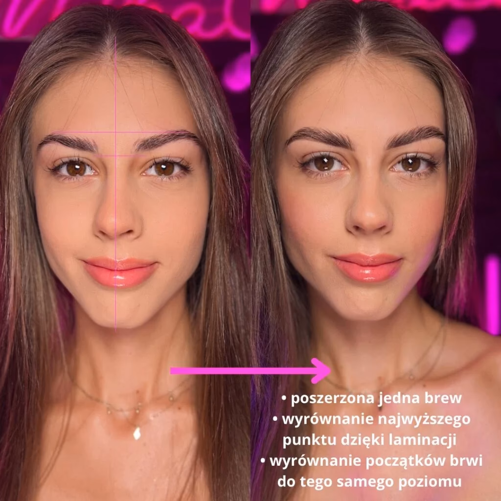 Dlaczego mam jedną brew wyżej od drugiej?