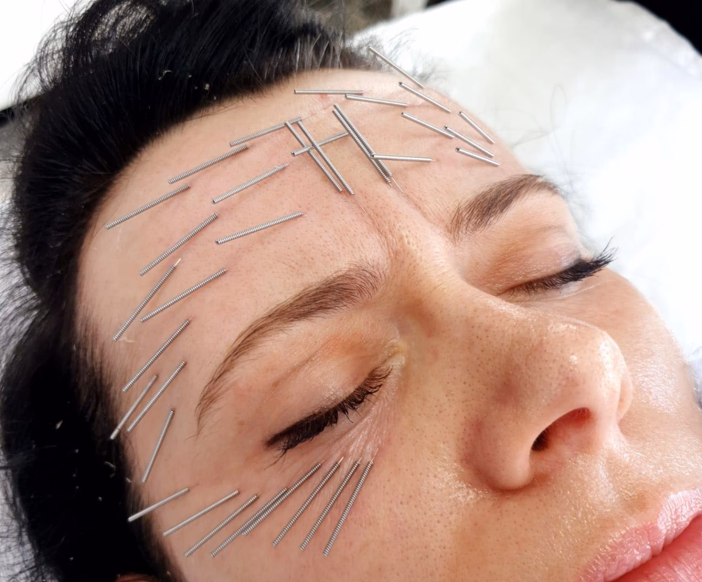 Jak długo utrzymuje się efekt po niciach?