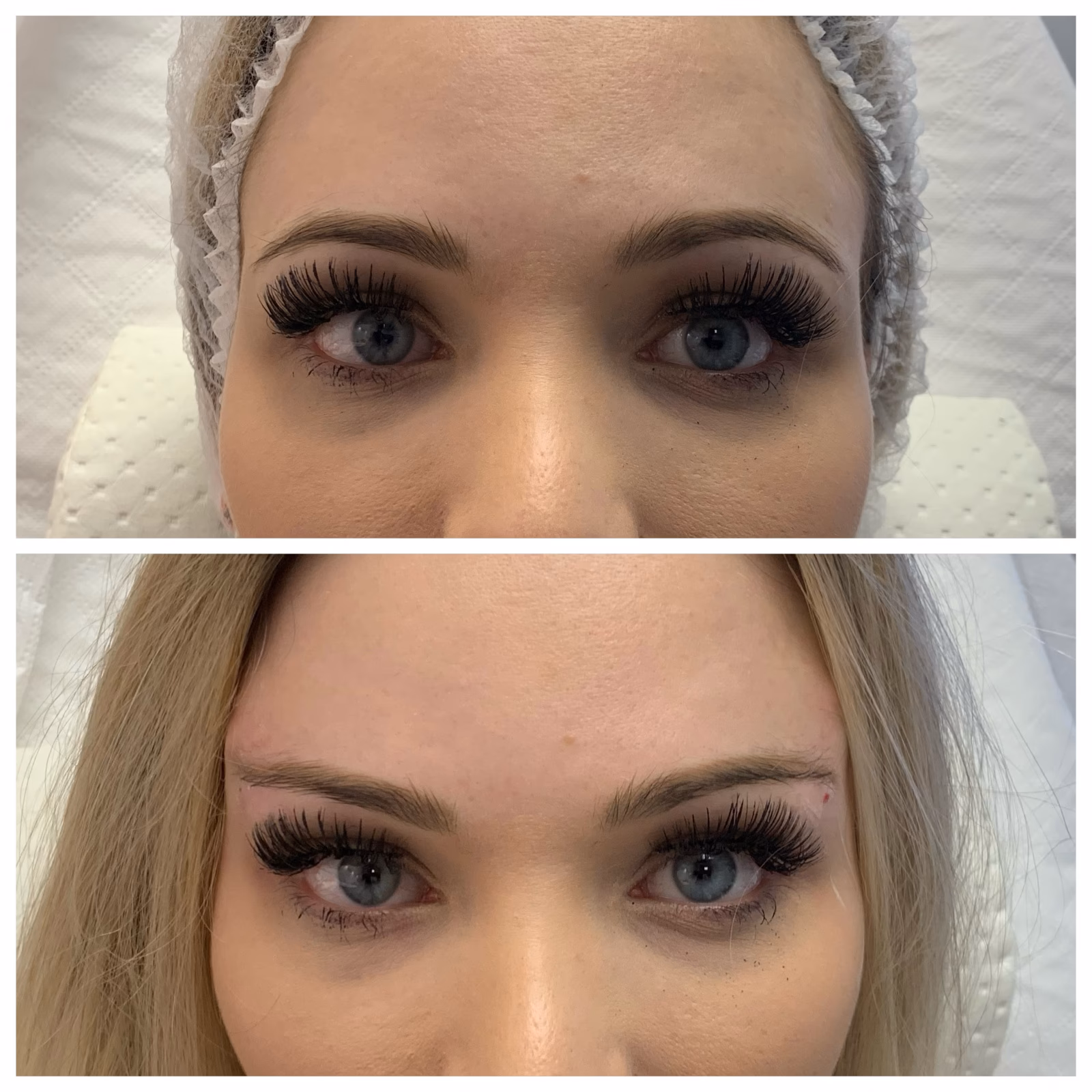 Jakie są skutki uboczne Lumi Eyes?