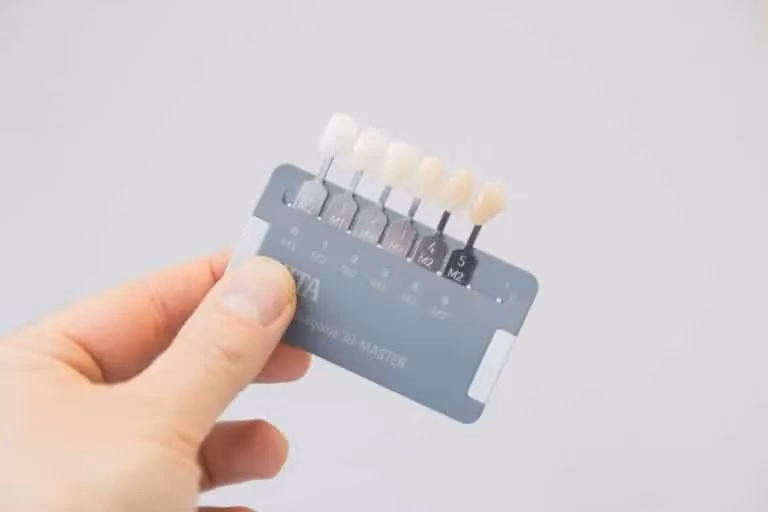 Ile czasu biała dieta po wybielaniu laserowym?