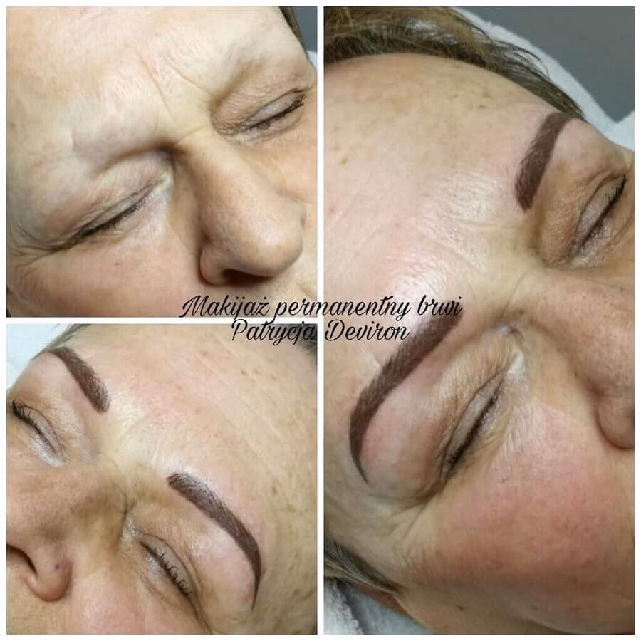 Na czym polega pigmentacja bielactwa?