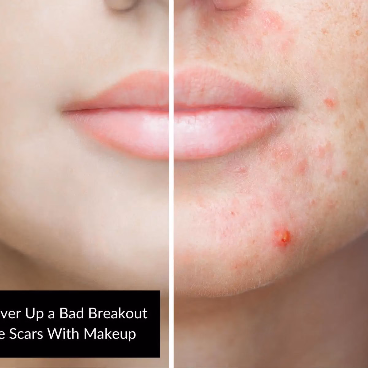 Jaki podkład do cery z bliznami potrądzikowymi?