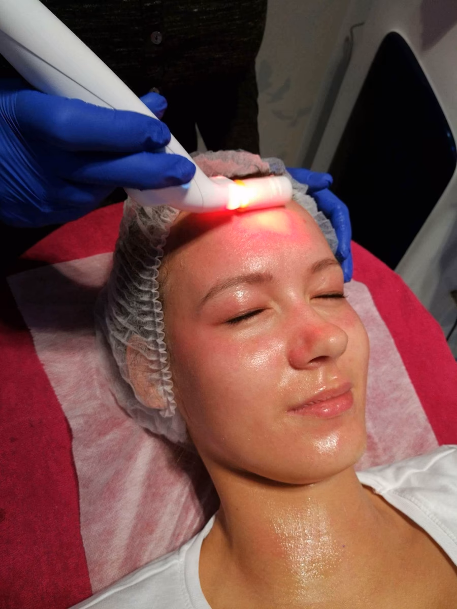 Czy Bloomea to laser?