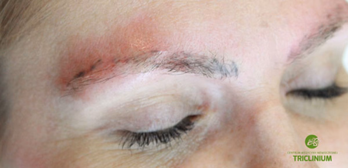 Co najlepiej zrobić, jeśli nie masz brwi?