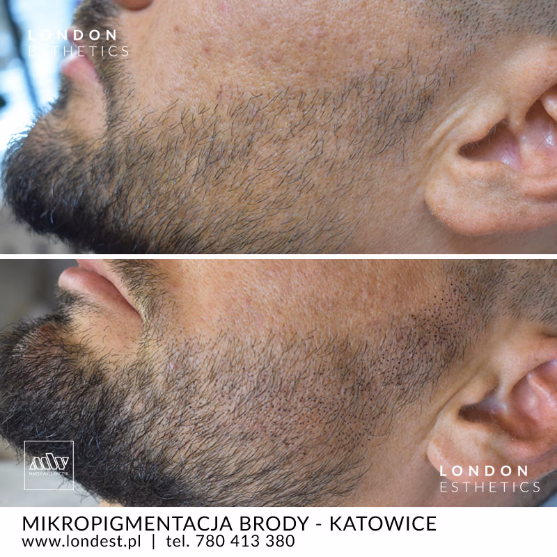 Po co mężczyznom broda?