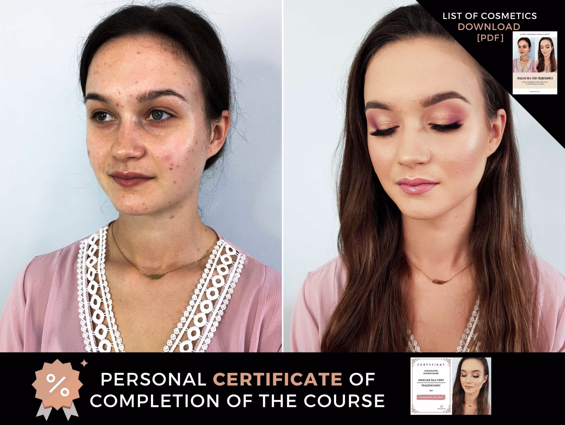 Jakich kosmetyków używać przy cerze tradzikowej?