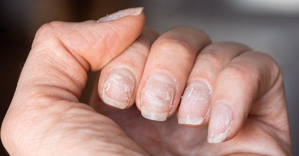 Co jest najlepsze na zniszczone paznokcie po hybrydzie?