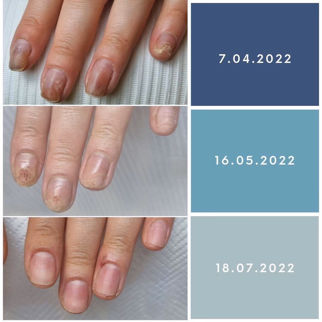 Co muszę wiedzieć przed zrobieniem paznokci?