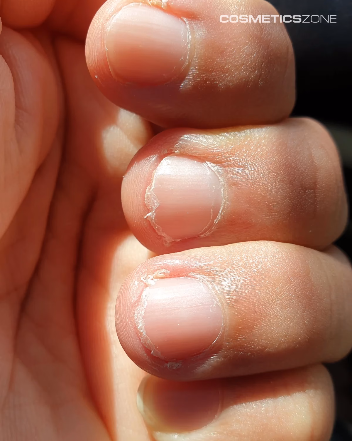 Czy można zrobić hybrydę na rozdwojonych paznokciach?