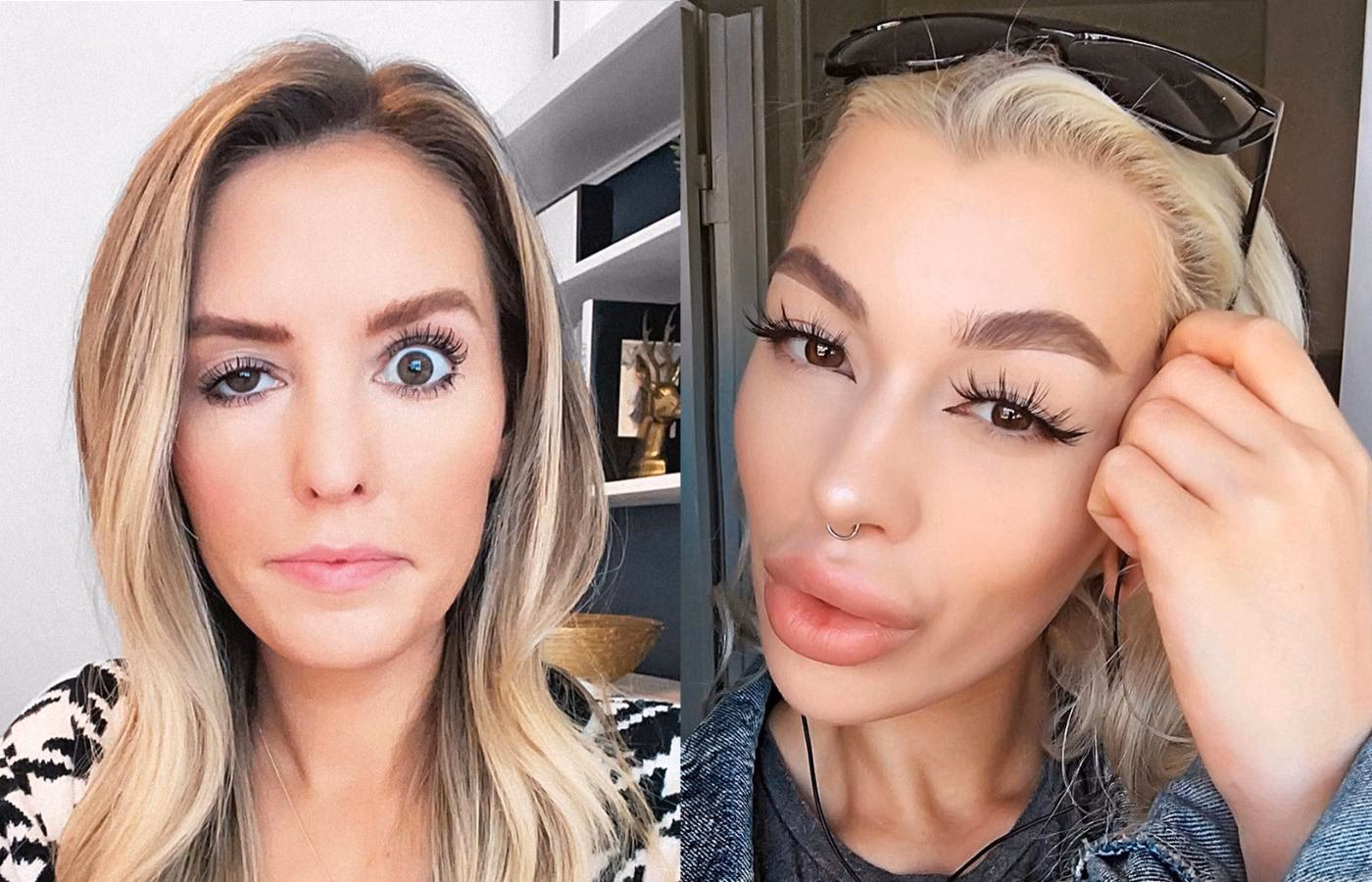 W których stanach kosmetolodzy mogą stosować botoks?