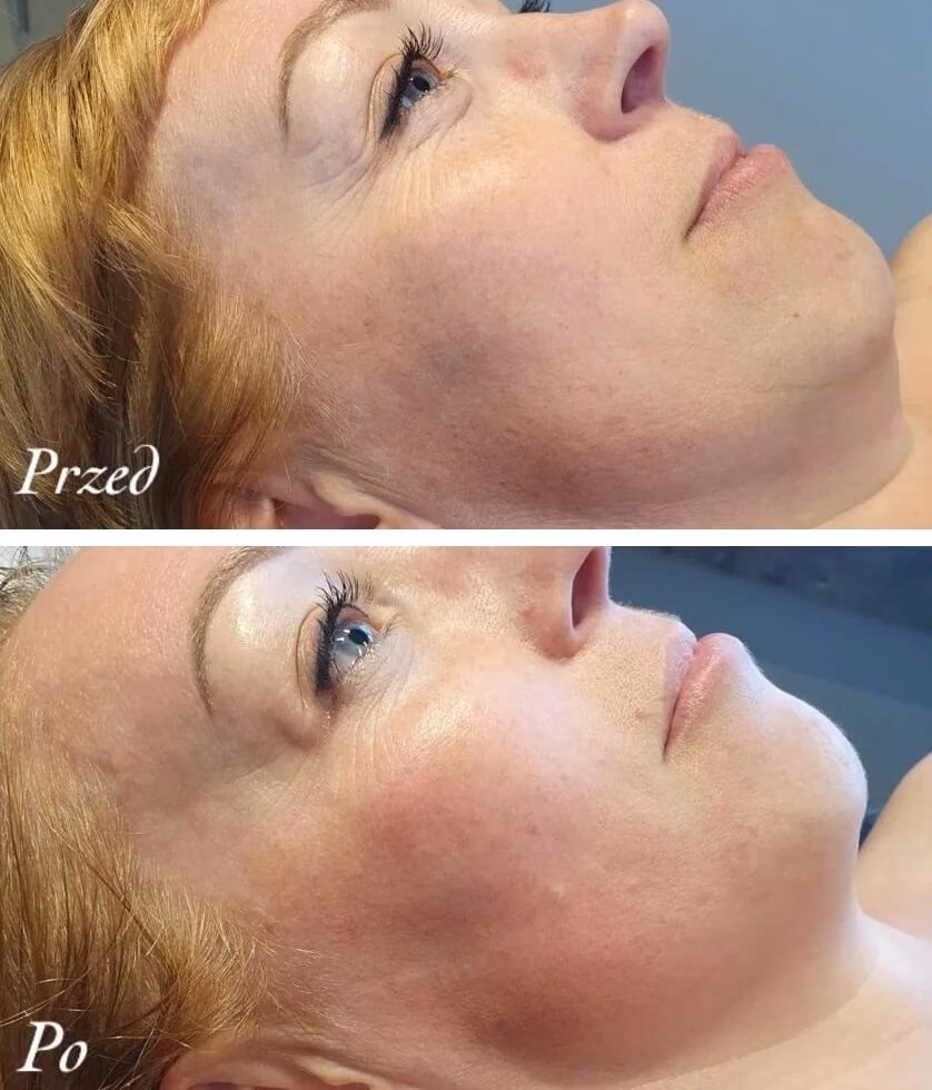 Kto może wykonywać masaż twarzy?