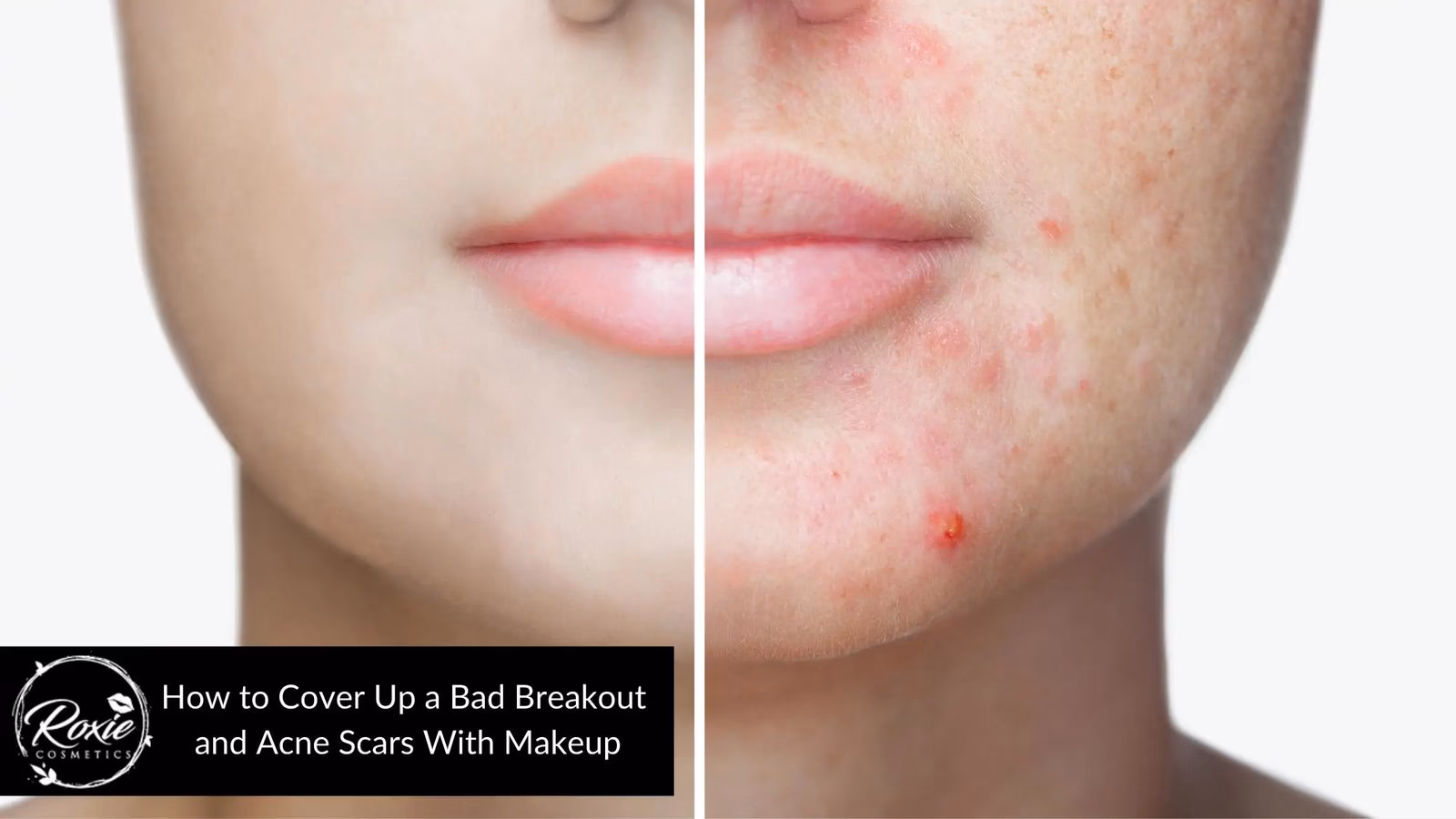 Co zrobić, żeby nie rosły włosy na brodzie u kobiety?