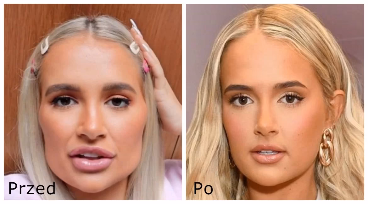 Czy po zabiegach na twarz można się malować?