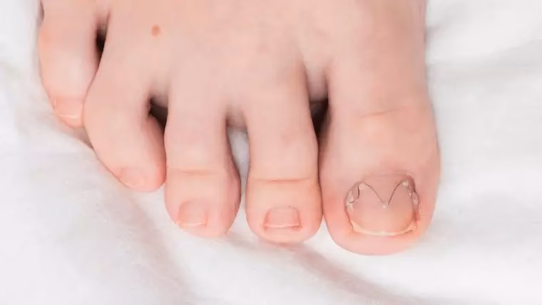 Jak odbudować mocno zniszczone paznokcie?