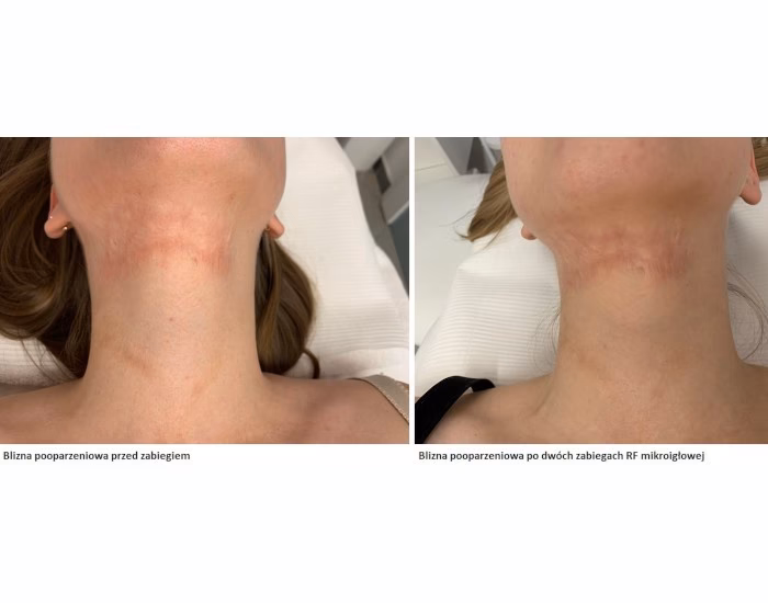 Czym są defekty kosmetyczne?