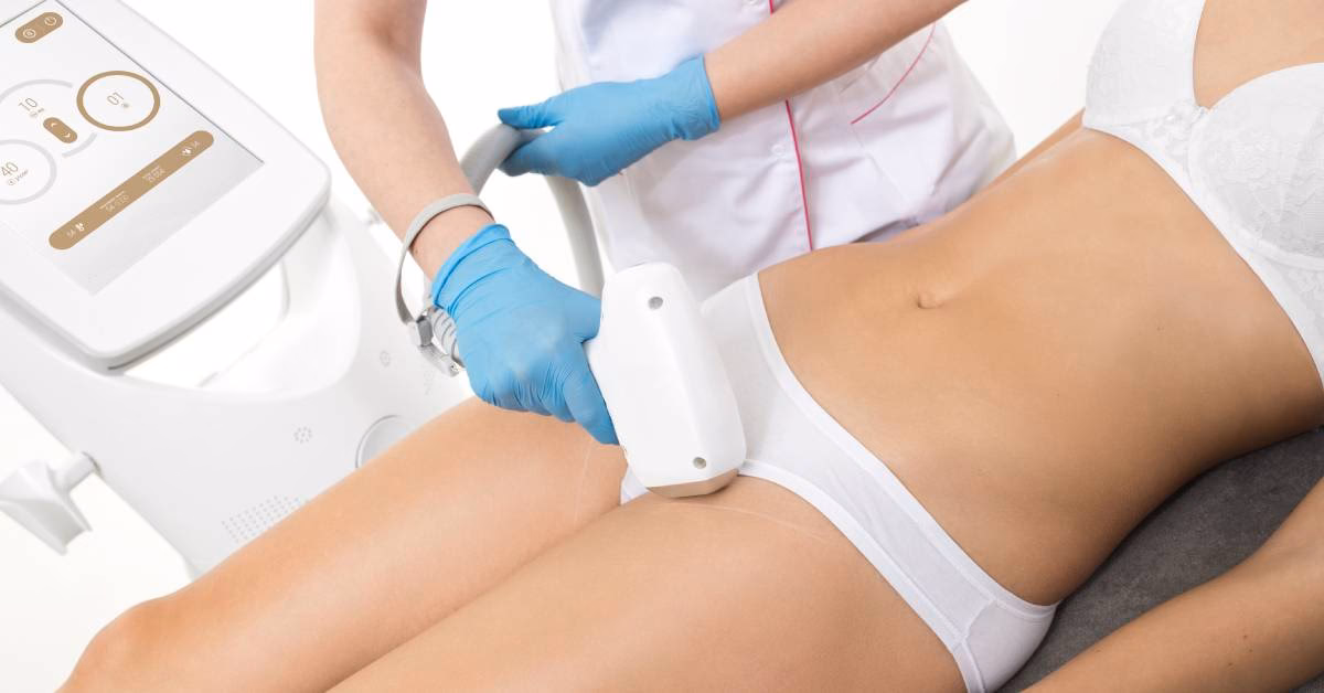 Czy po depilacji laserowej może boleć brzuch?