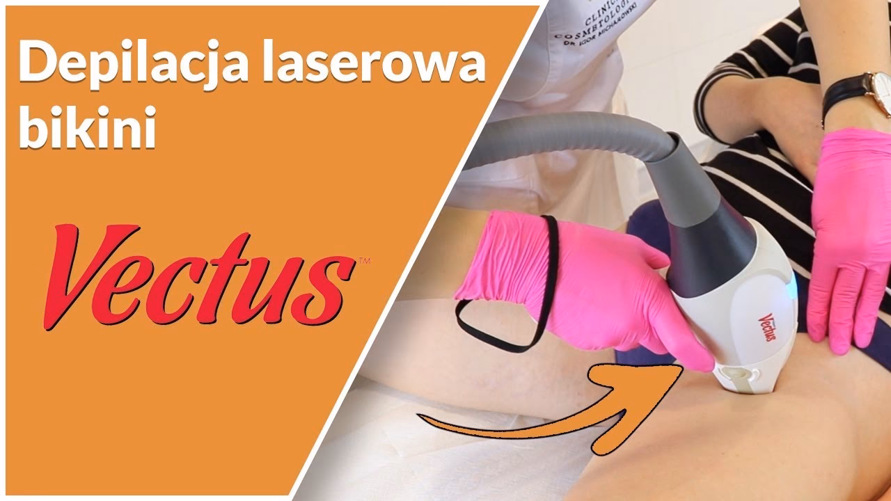 Czy depilacja laserowa głębokiego bikini boli?