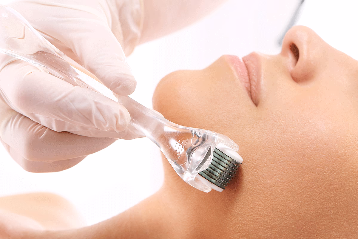 Jaki Derma roller jest najlepszy?