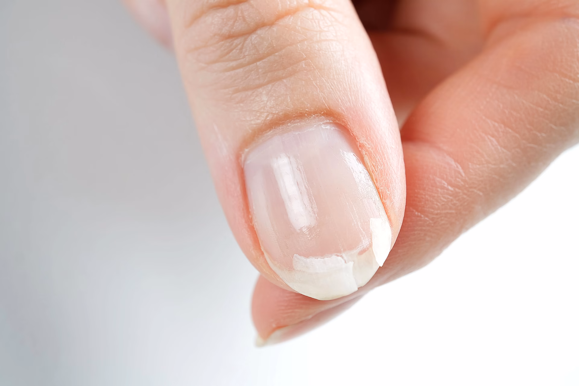 Co zrobić, gdy paznokcie się rozdwajają?