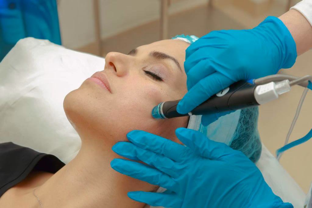 Jaki jest najlepszy zabieg na odmłodzenie twarzy?
