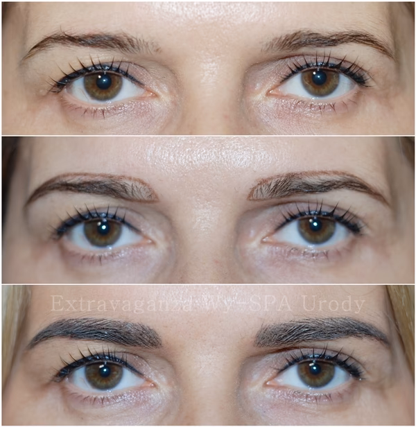 Ile kosztuje uzupełnienie pigmentu na brwi?