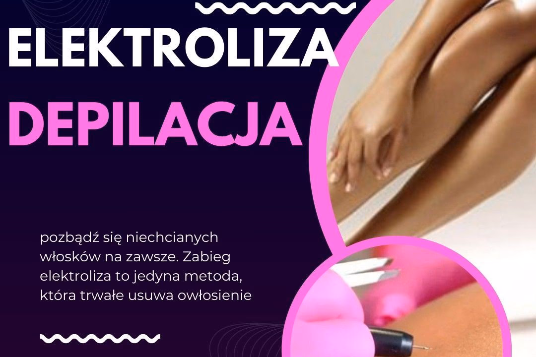 Jaki jest koszt elektrolizy twarzy?