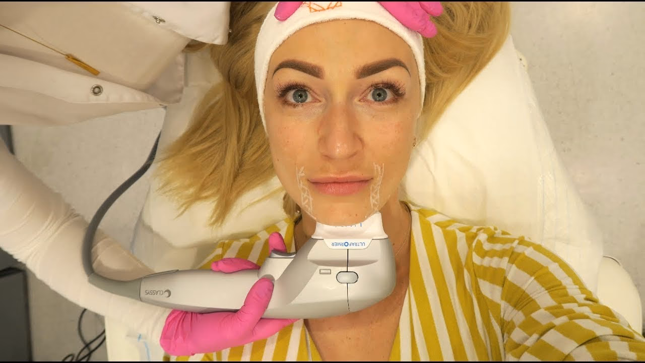 Ile kosztuje zabieg Face HIFU?