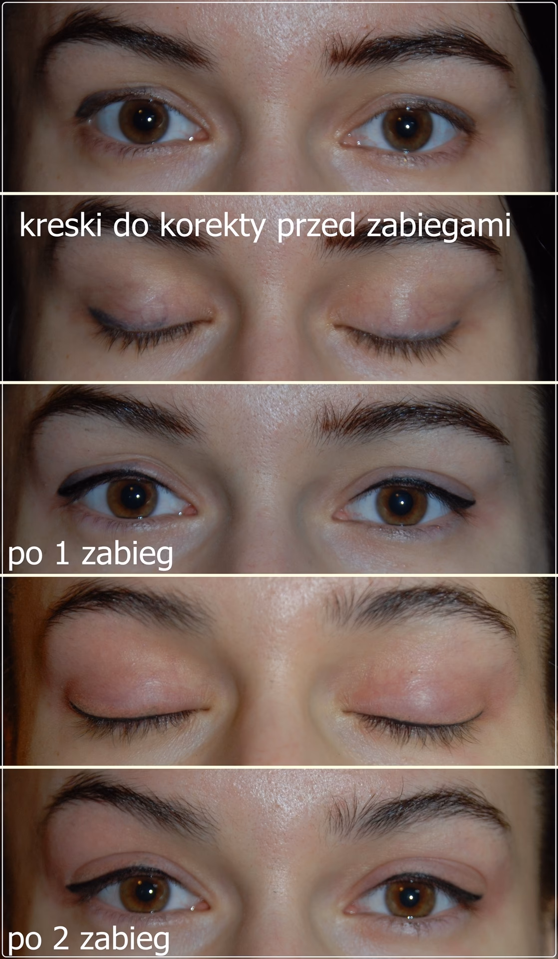 Kiedy można robić makijaż po zabiegu zaćmy?