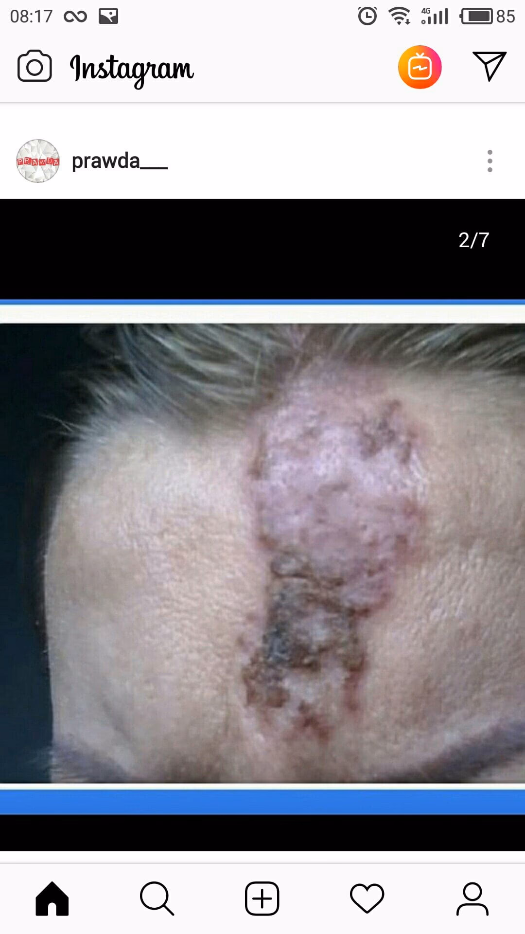 Czy można pozwać kosmetyczkę?