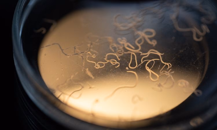 Jak pozbyć się glizdy ludzkiej z organizmu?