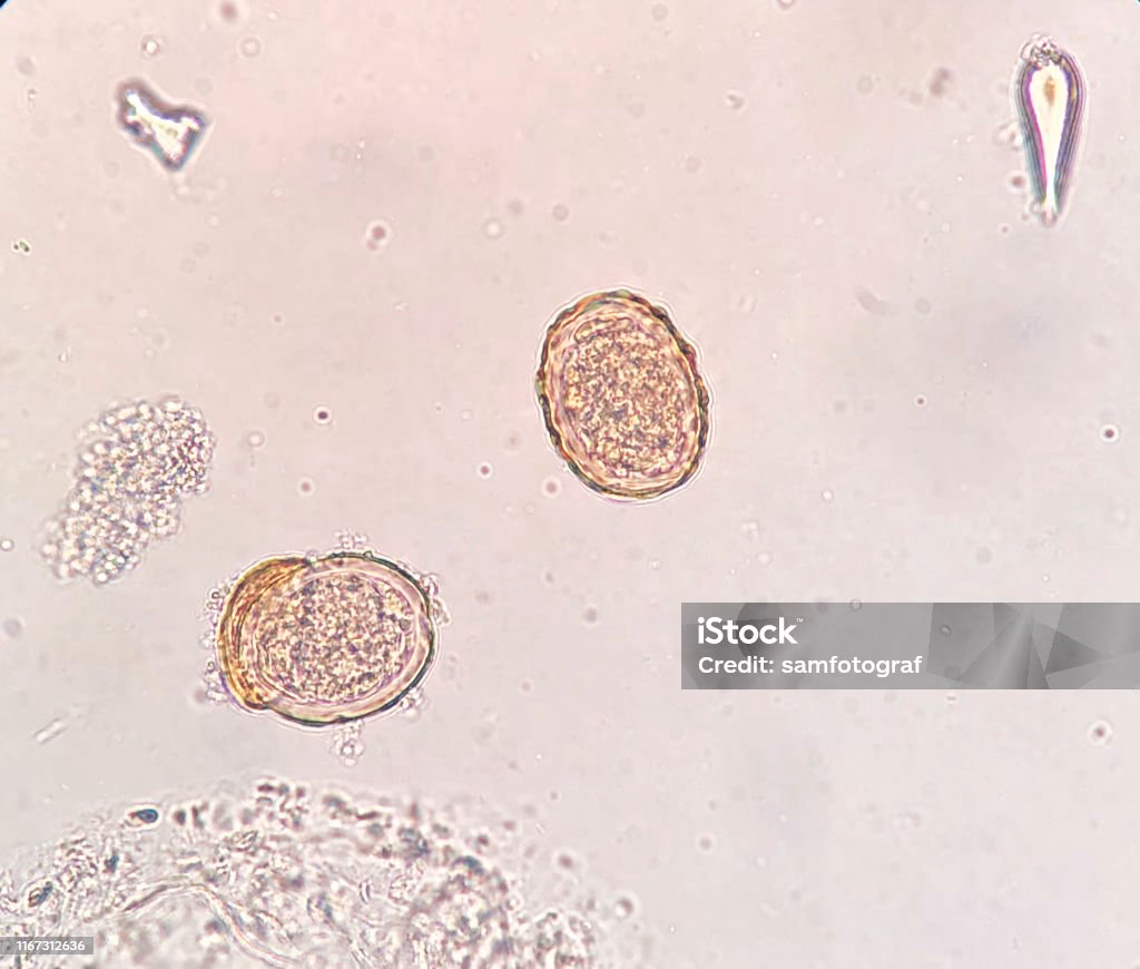 Co zabija jaja glisty ludzkiej?