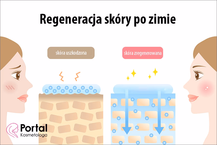 Jakie zabiegi na twarz zimą?