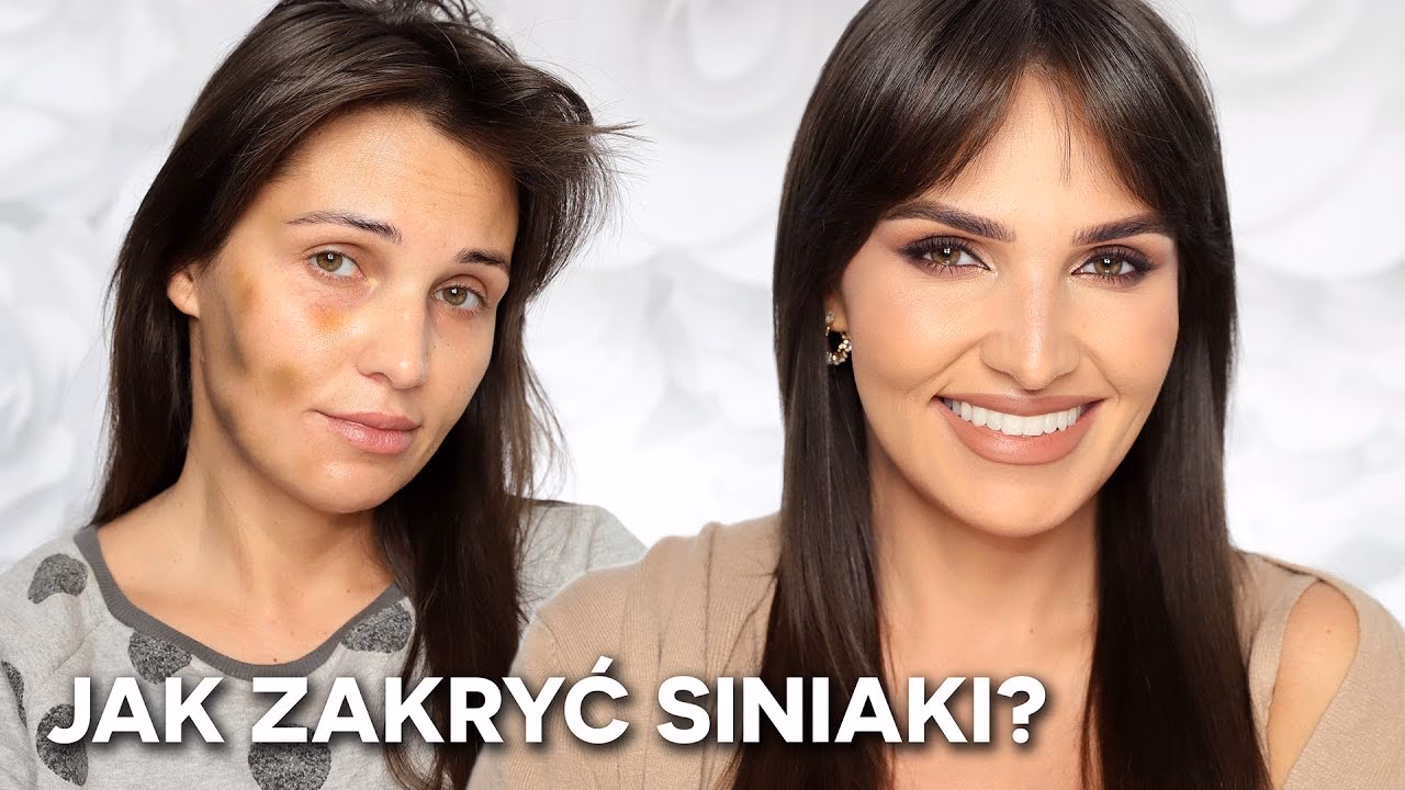 Jakim kolorem zakryć siniaka?