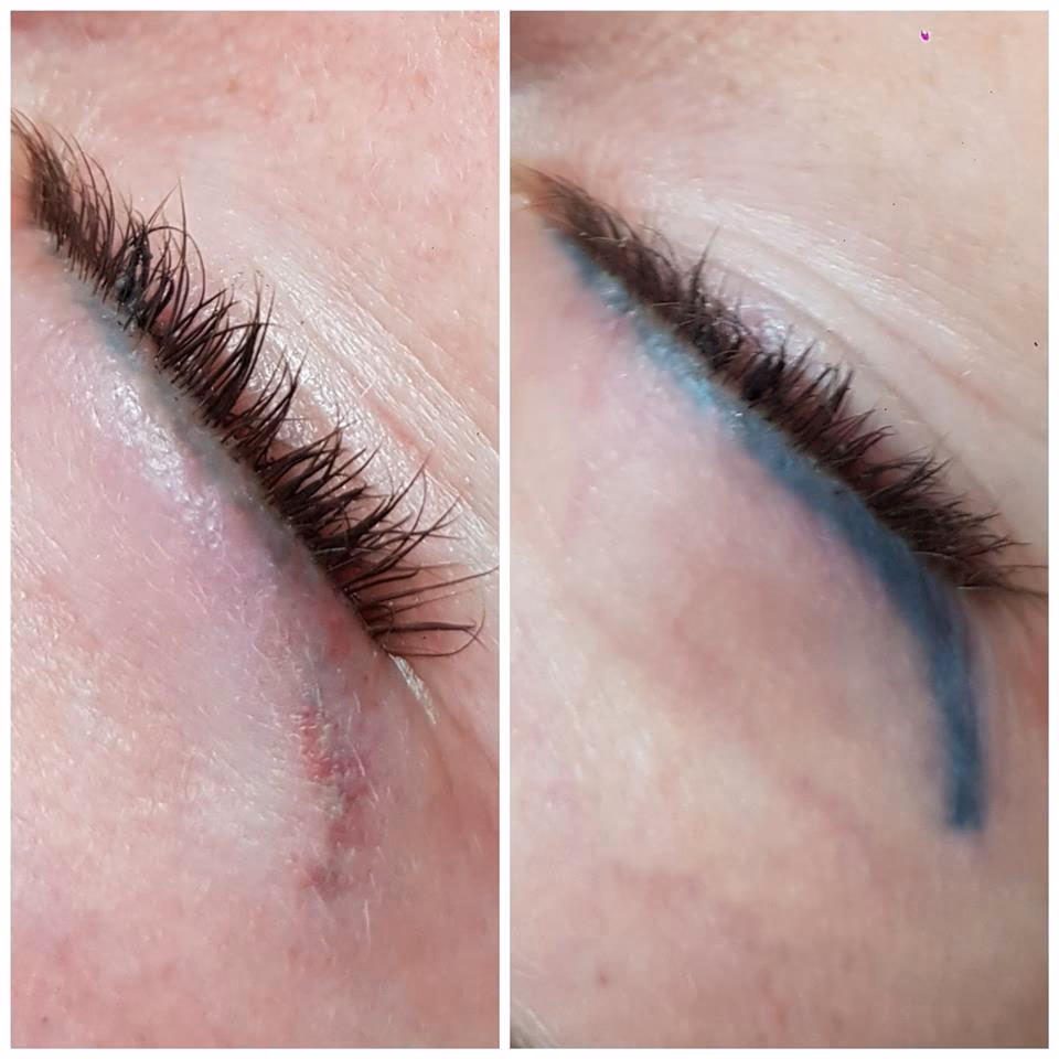 Czy można usunąć makijaż permanentny z powiek?