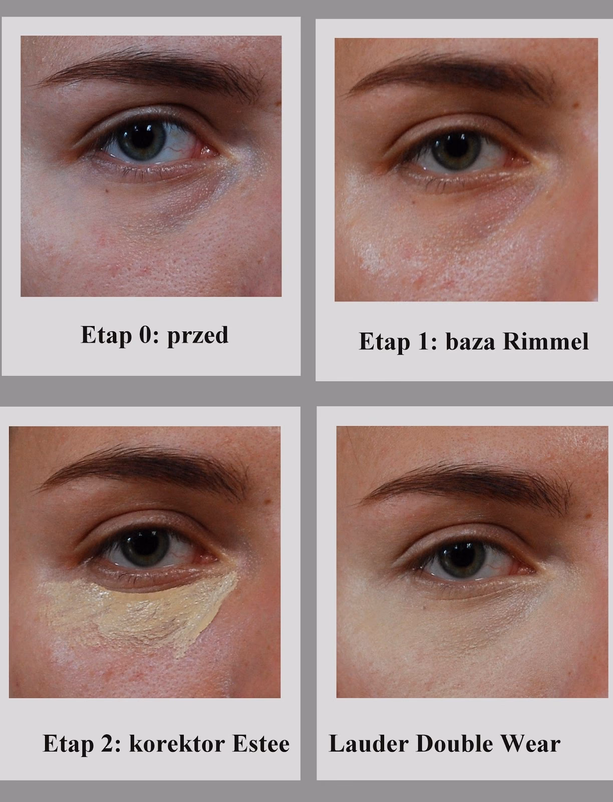 Co likwiduje wory pod oczami?