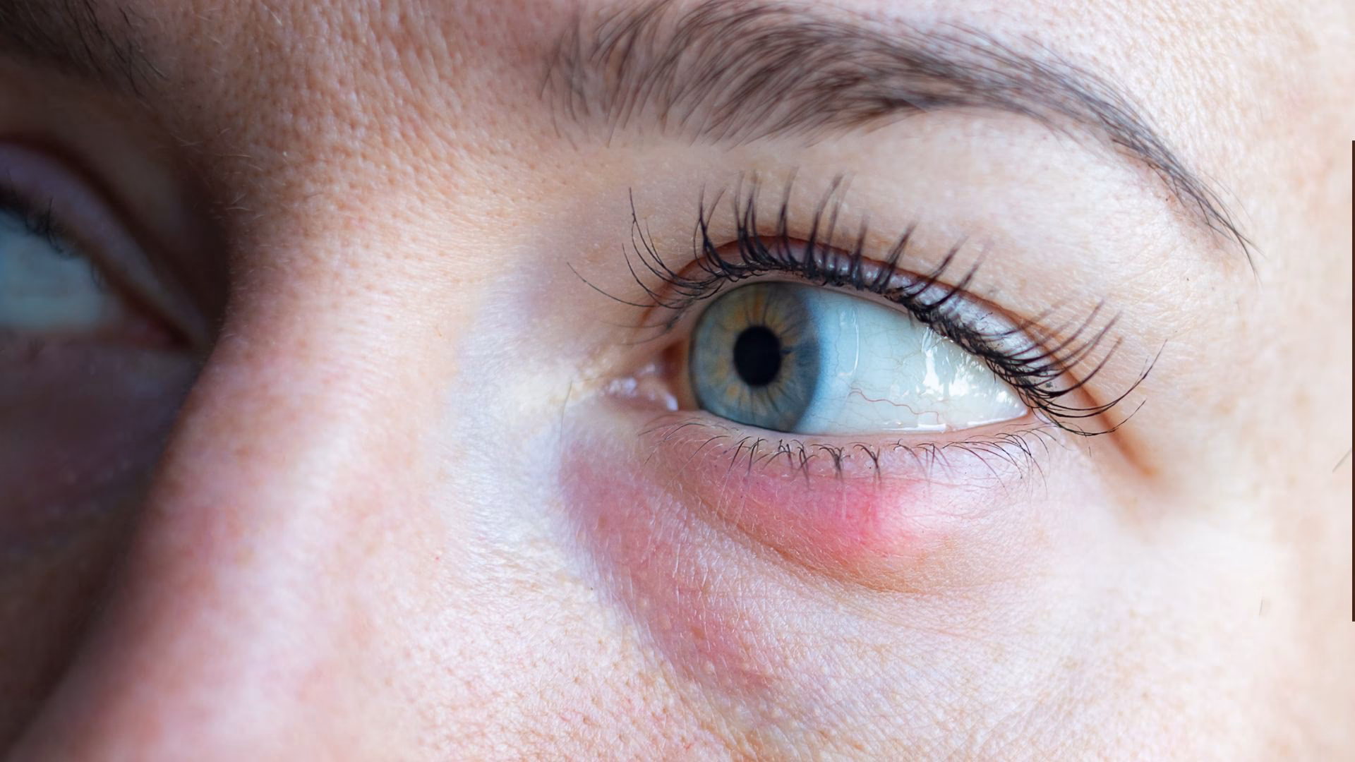 Czy można malować oko z jęczmieniem?