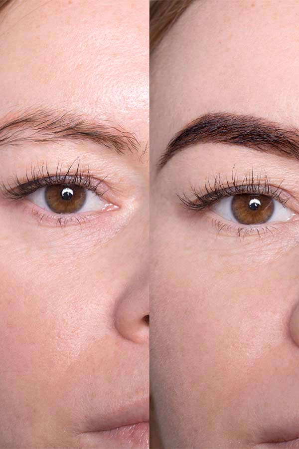 Jaki zabieg jest najlepszy na brwi?