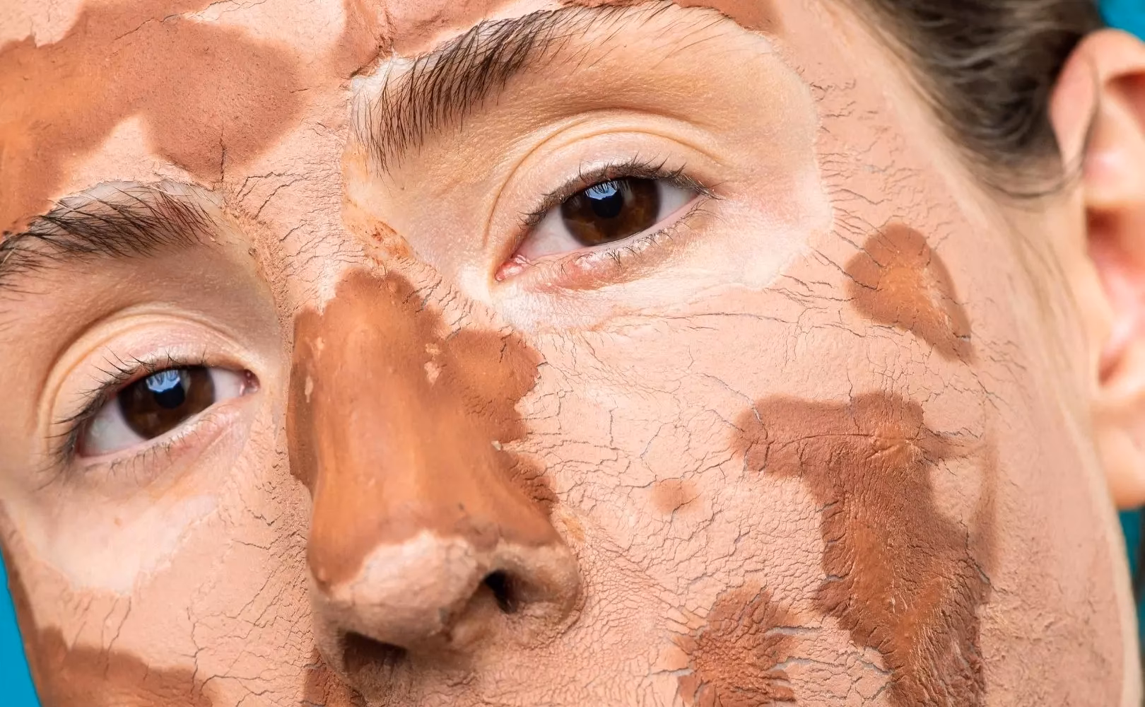 Jaki zabieg na cerę sucha?