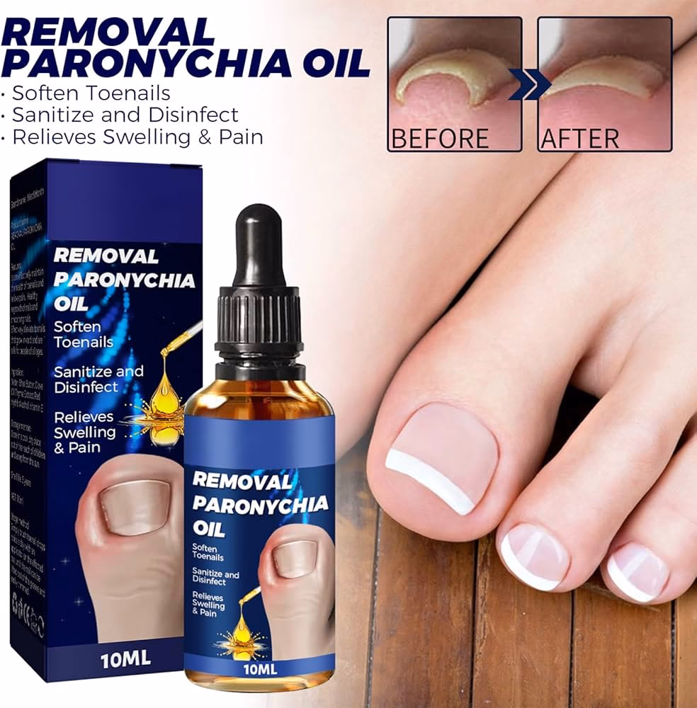 Czym zastąpić liquid do paznokci?