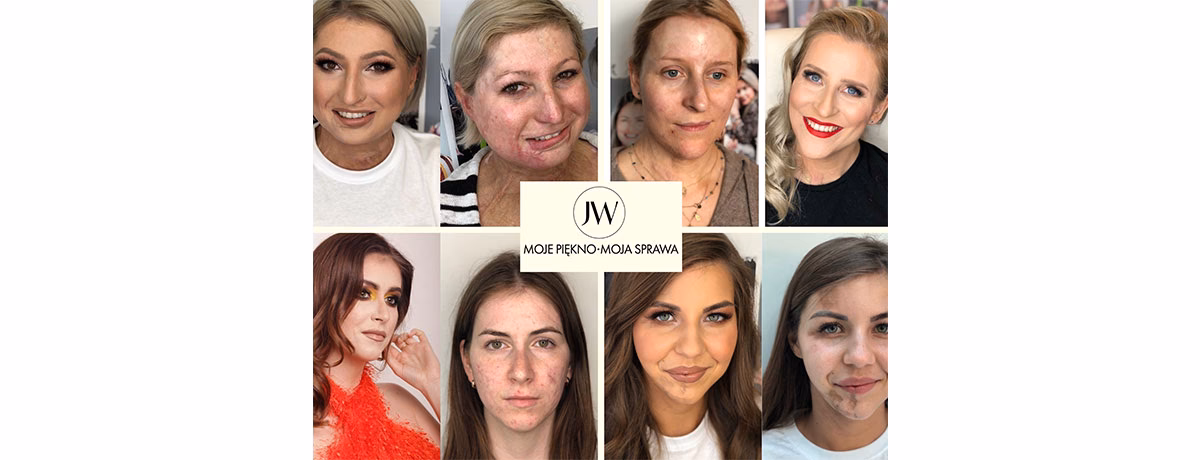 Jak pozbyć się hejtu?