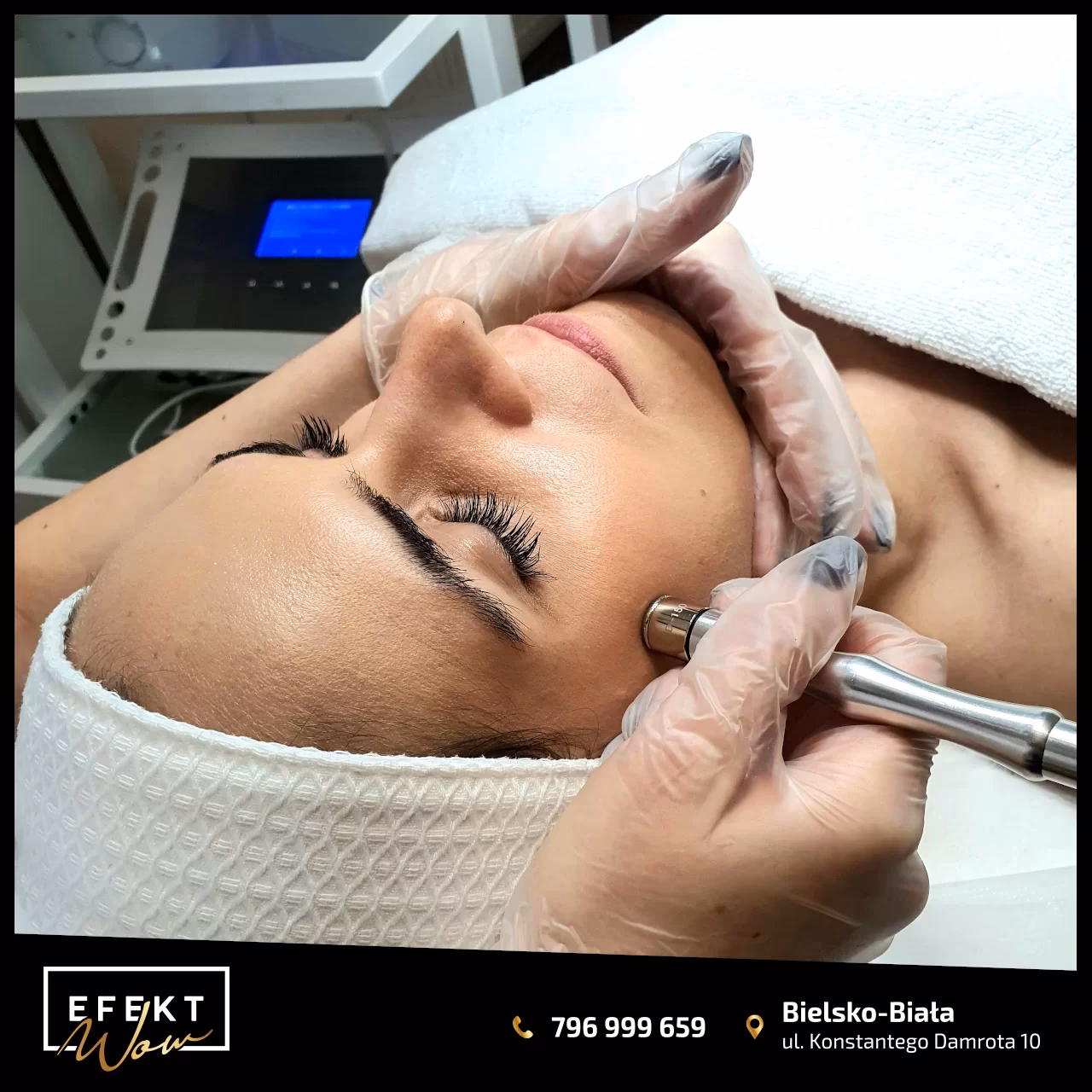 Jakie są wady mikrodermabrazji?