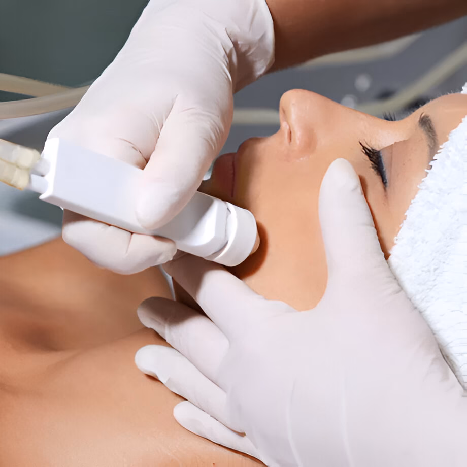 Czy mikrodermabrazja to dobry zabieg?