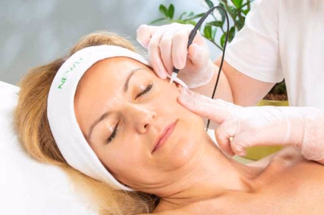 Czy kosmetyczka może usunąć prosaki?