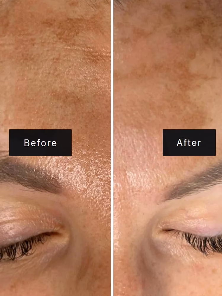 Z czym nie należy łączyć kwasu ferulowego?