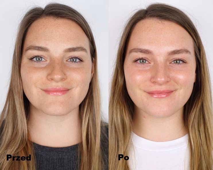 Czego nie robić po kwasie migdałowym?