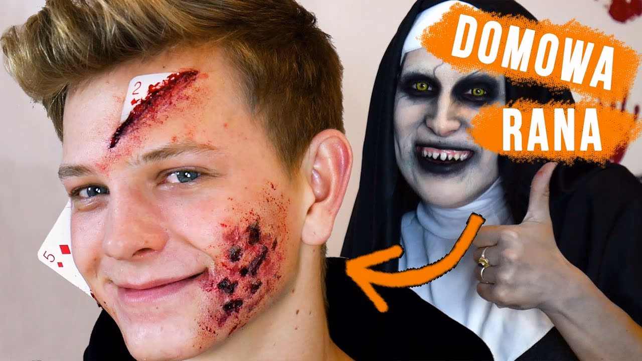 Dlaczego rana swędzi podczas gojenia?