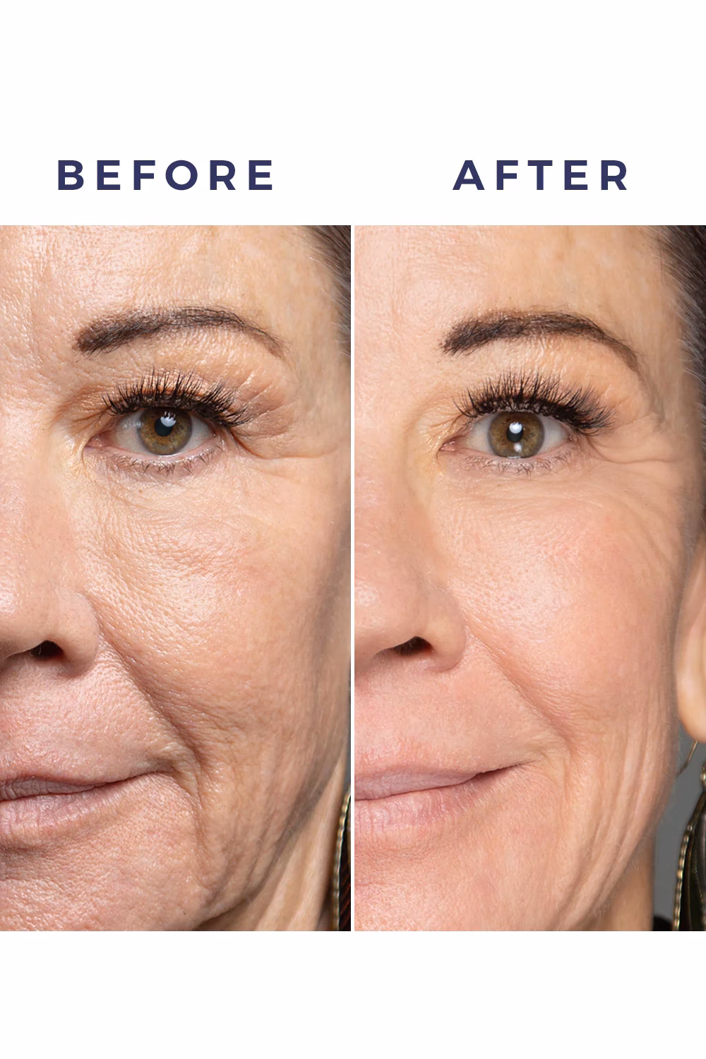 Co to są kosmetyki anti-aging?