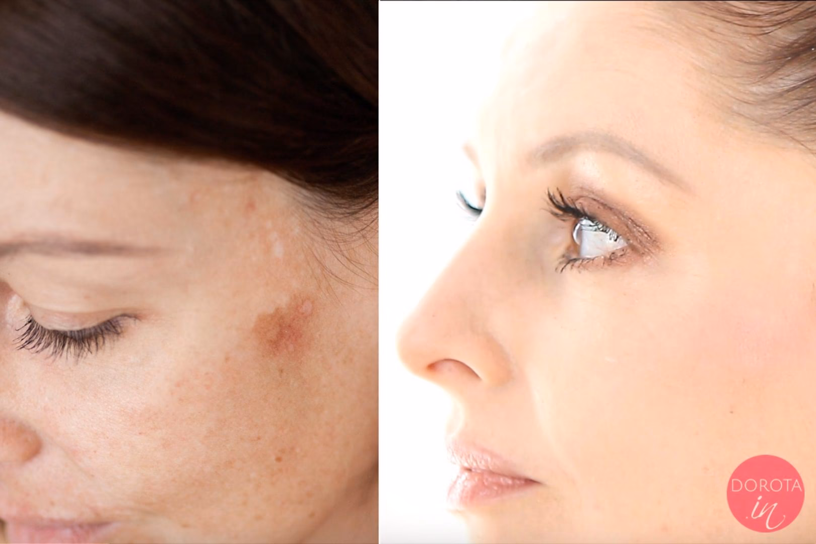 Jaki korektor zakryje przebarwienia?